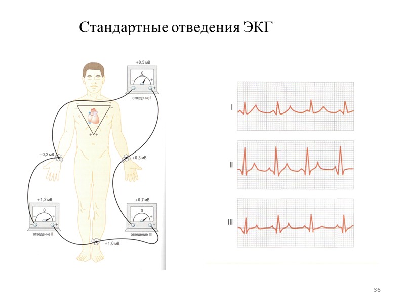 36 Стандартные отведения ЭКГ